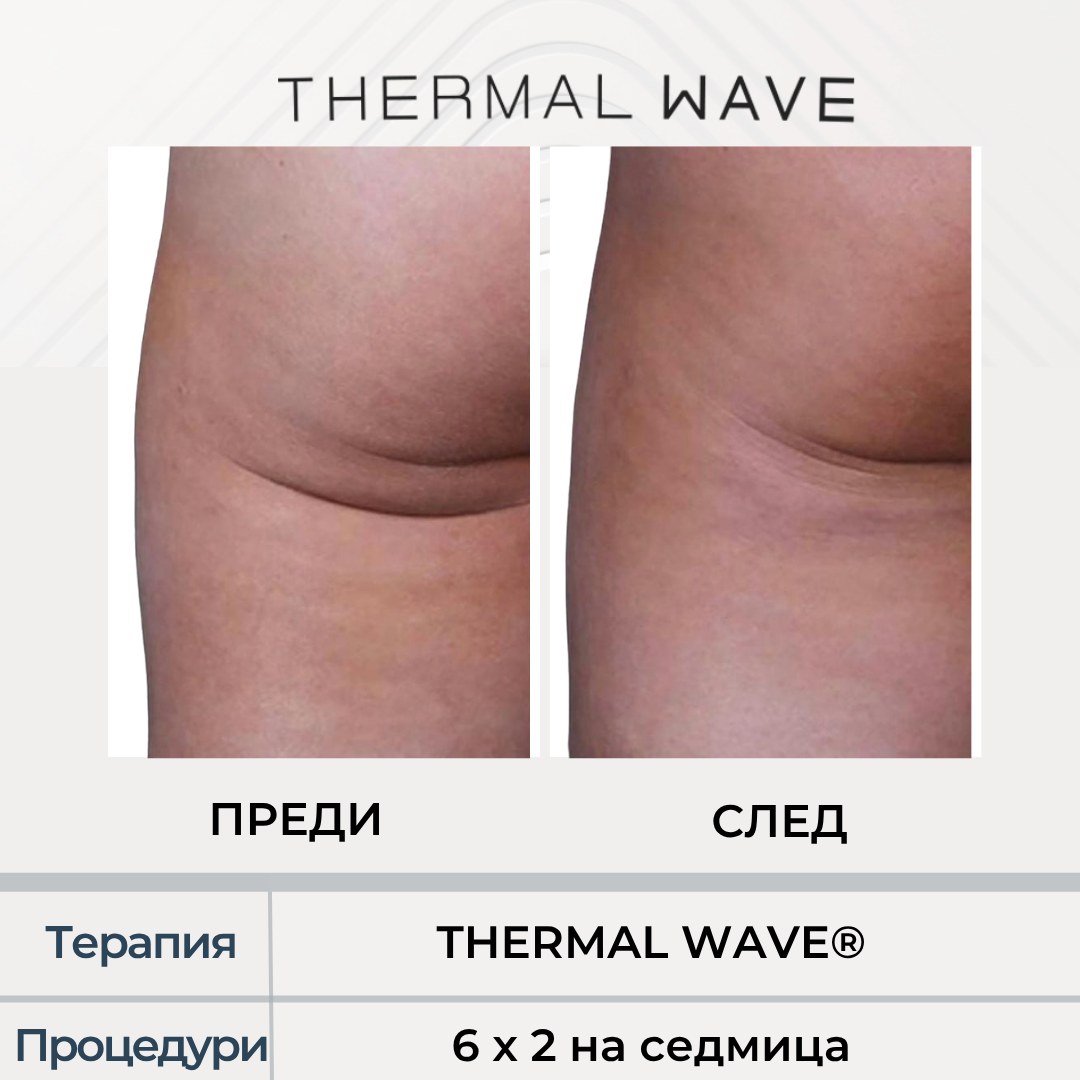 Седалище преди и след THERMAL WAVE