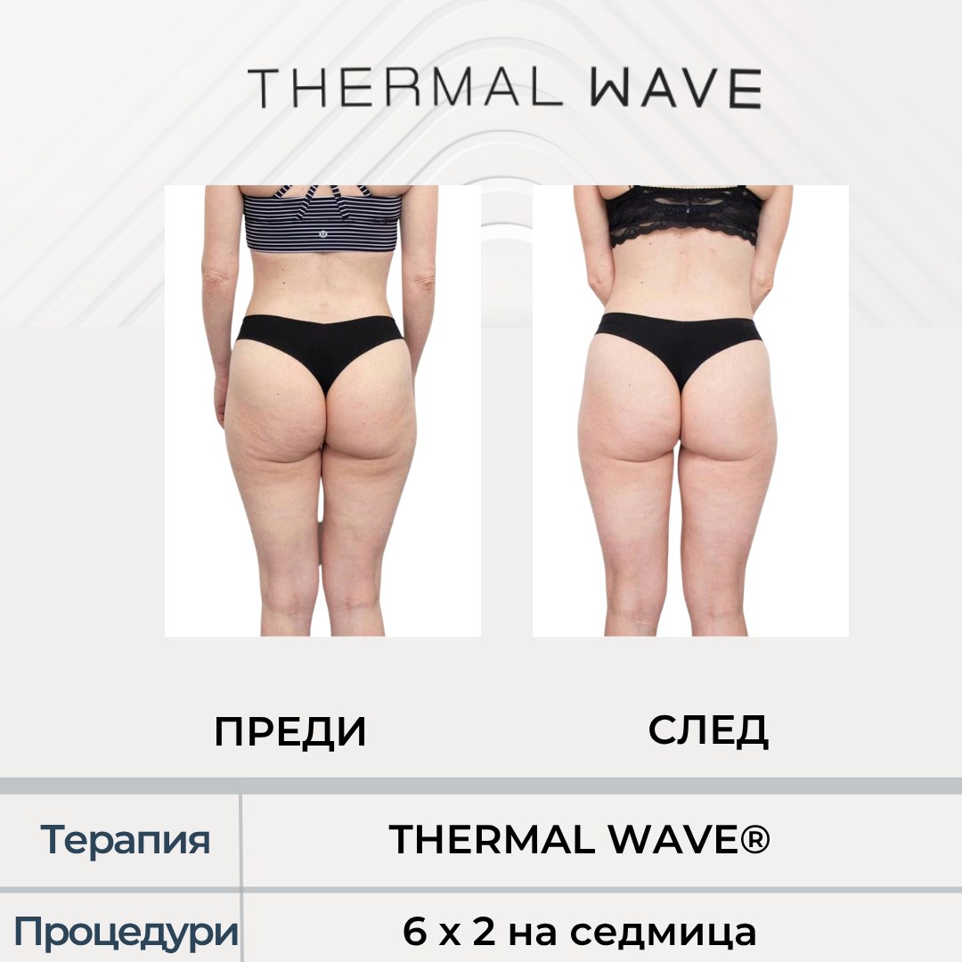 Седалище и бедра преди и след курс с THERMAL WAVE